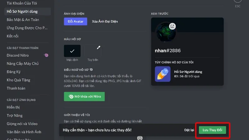 Cách thay đổi ảnh đại diện tài khoản Discord đơn giản, nhanh chóng