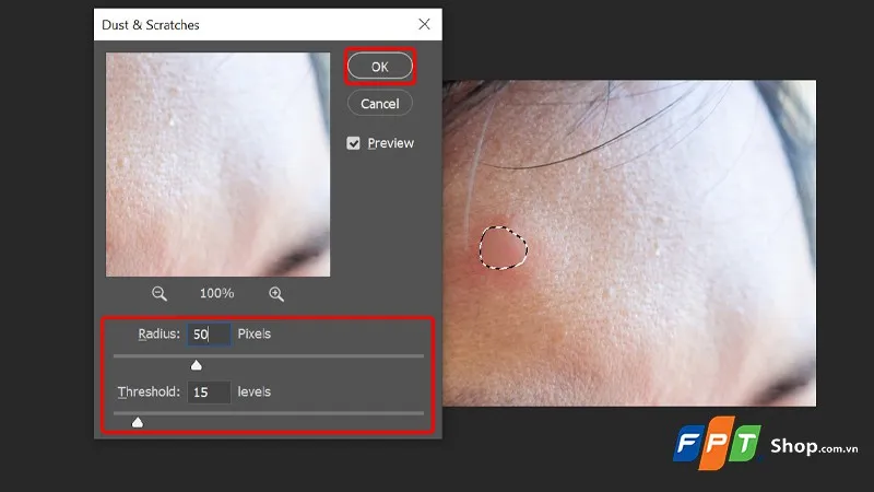 Cách xóa mụn trong Photoshop mới nhất năm 2024, chuyên nghiệp và nhanh chóng