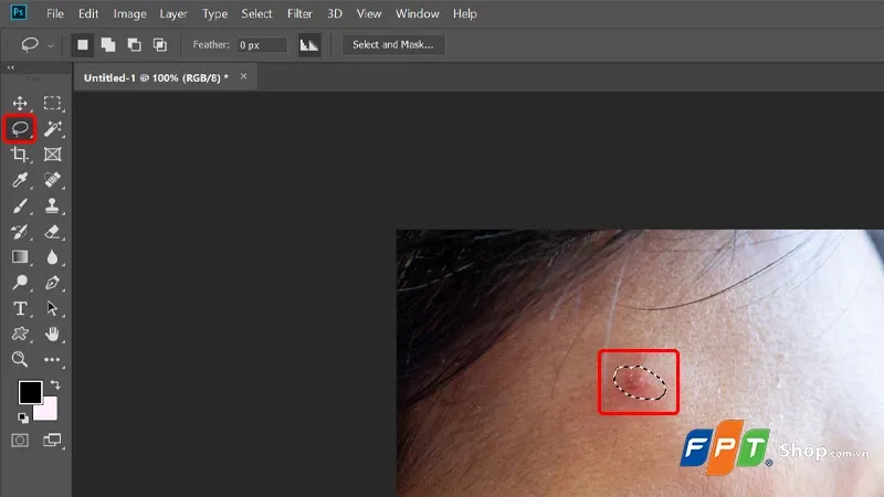 Cách xóa mụn trong Photoshop mới nhất năm 2024, chuyên nghiệp và nhanh chóng